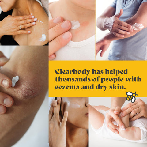 Organic Honey Eczema Cream