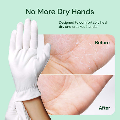 Organic Cotton Gloves For Dry Hands 10 Pack